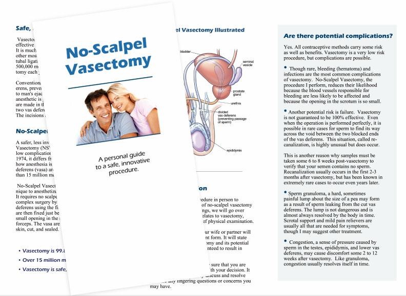 Patient Brochures No Scalpel Vasectomy Counseling Patient Brochures No Scalpel Vasectomy Counseling
